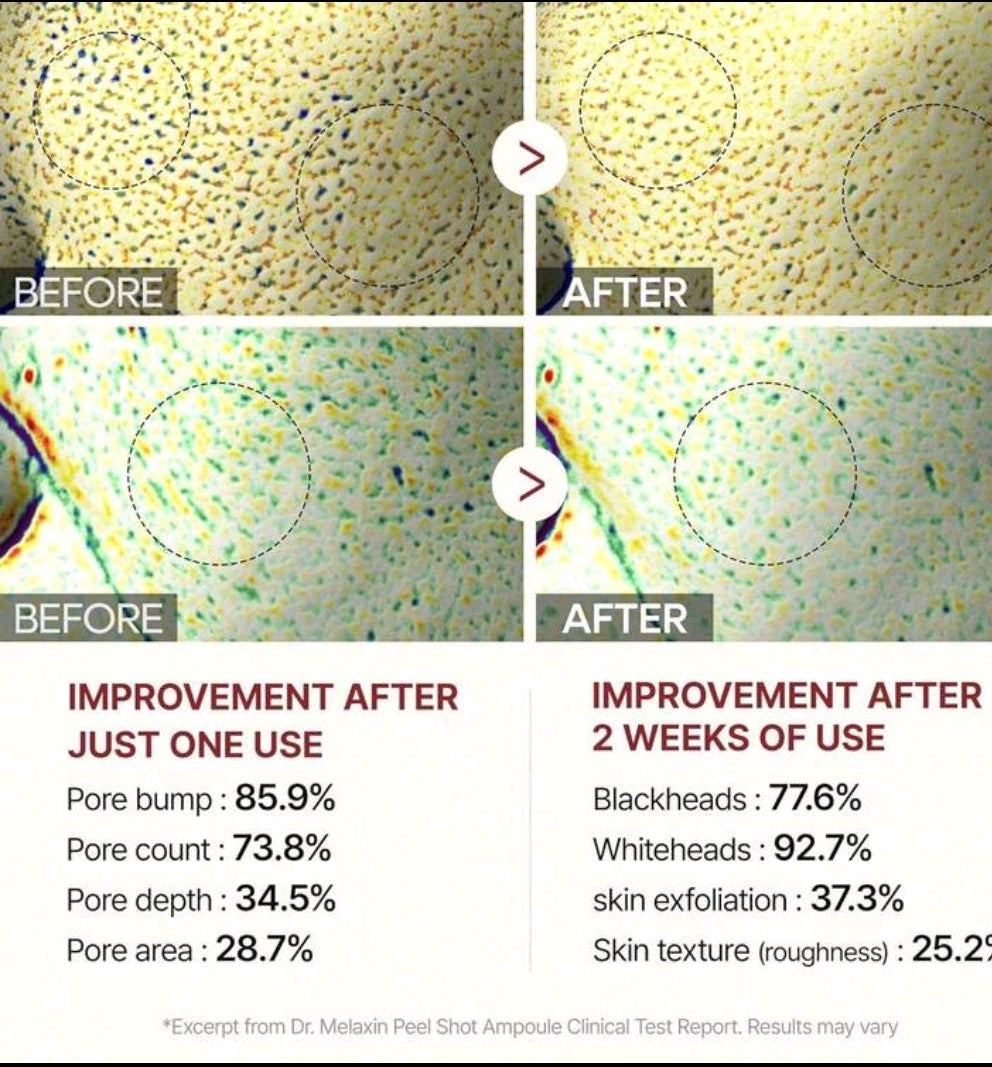 DR. MELAXIN Exfoliating Black Rice Ampoule PEEL SHOT
